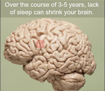 今天是世界睡眠日有证据表明持续3-5年的缺乏睡眠会导致大脑神经萎缩美国神经学学会在《神经学》杂志上发布的一项研究表示，睡眠问题可能导致脑容量的快速衰退