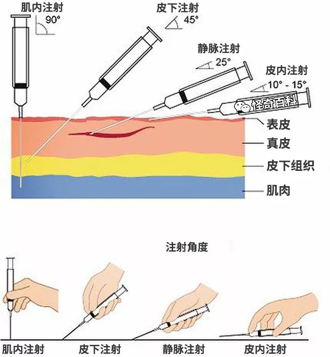 不同注射方式的区别 #无用但有趣的冷知识