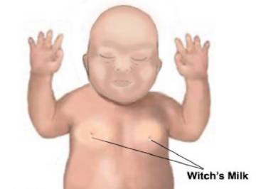 新生儿乳头溢出的乳汁在西方被称为女巫的乳汁(Witches'milk)，不管是男宝宝还是女宝宝，大概5%的刚刚生出来的婴儿会产奶